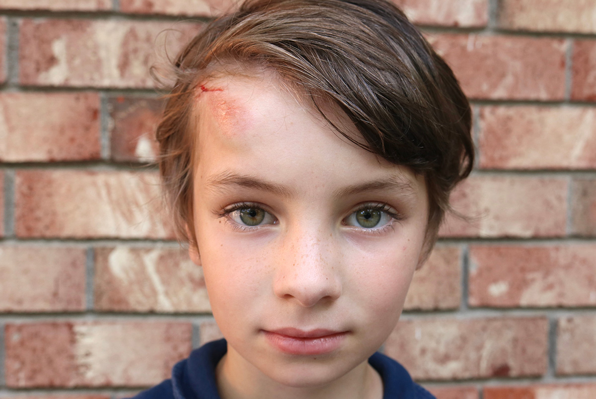 Slip and fall accidents are common but not every slip and fall is eligible for a liability case. While we hope you never need to use our services, it's important to know what to do after a slip and fall.